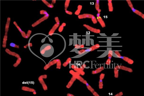 美国试管婴儿基因检测