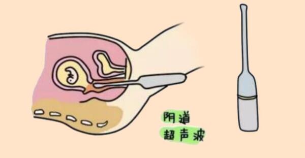 阴超