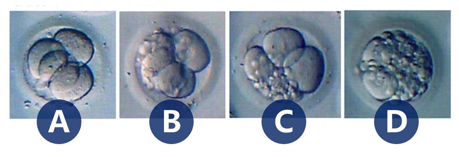 囊胚-ABCD.jpg