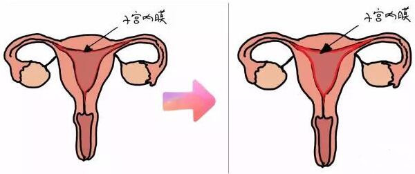 子宫内膜薄