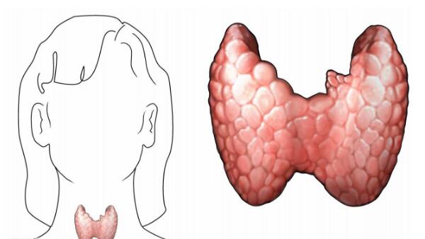 甲状腺炎