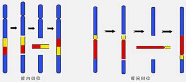 染色体臂间倒位