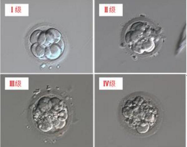 胚胎评级