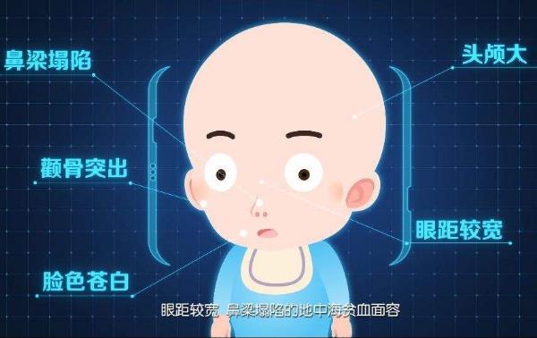 地中海贫血宝宝.jpg