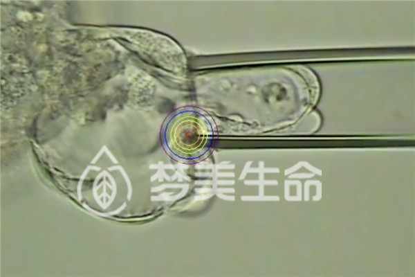 美国试管囊胚细胞切片提取
