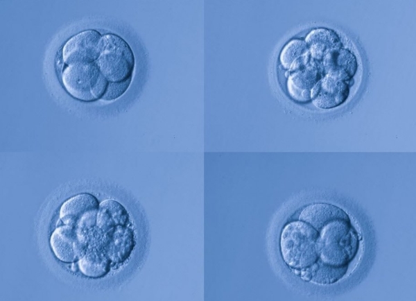 胚胎等级