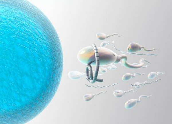 抗精子抗体