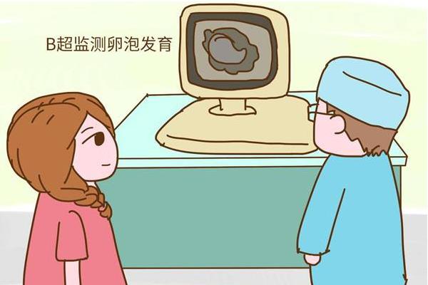 卵泡监测