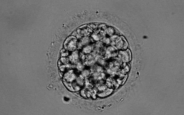 胚胎质量
