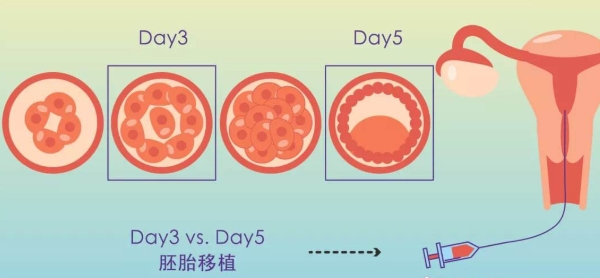 定性定量移植