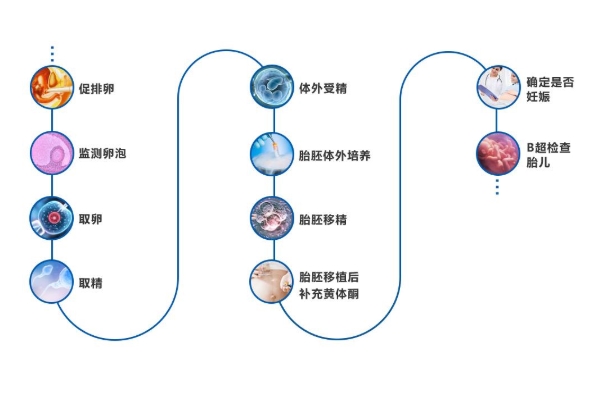 试管婴儿流程