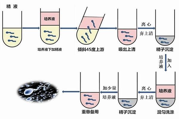 Perecoll梯度离心精子洗涤技术.jpeg