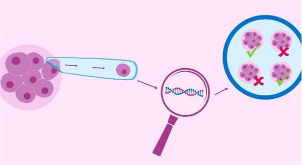 胚胎基因筛查