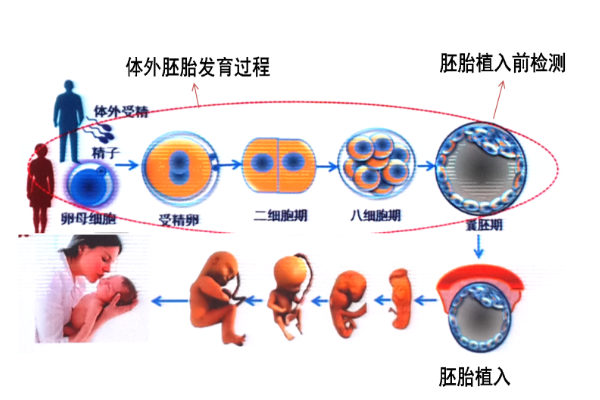 植入前胚胎检查