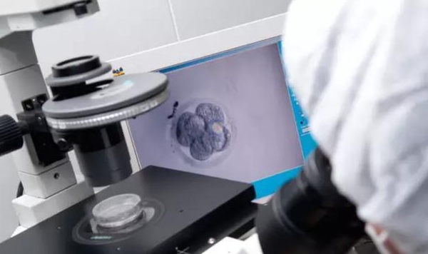 胚胎基因筛查