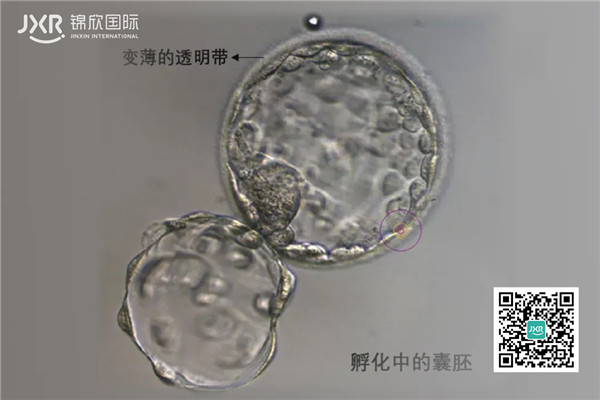 胚胎基因检查