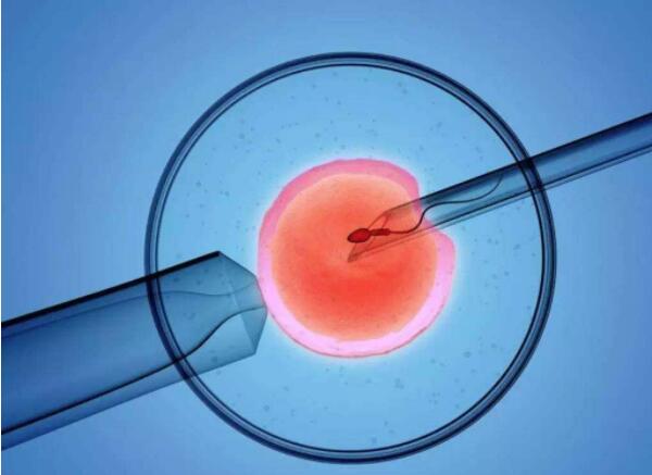 单精子注射技术