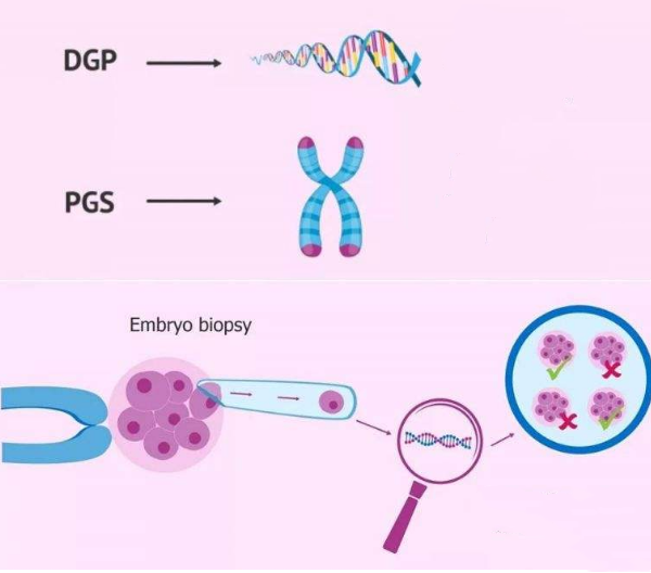 pgd、pgs基因检查技术