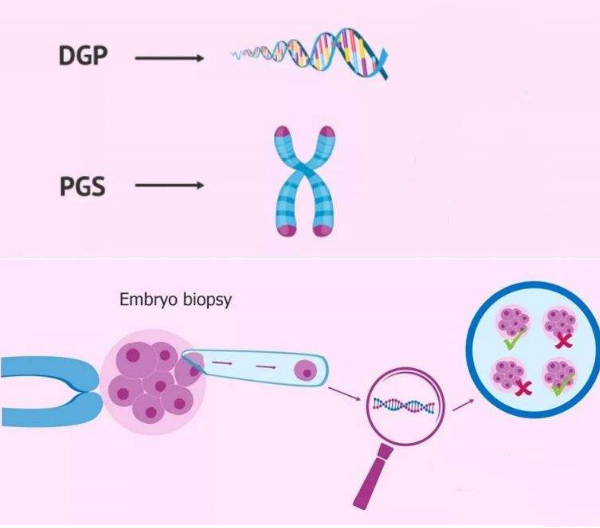 PGS/PGD基因检测技术