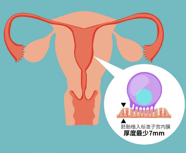 子宫内膜因素