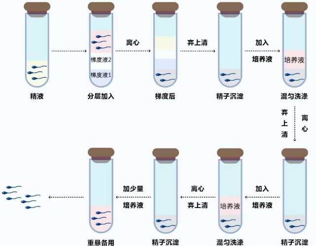 精子洗涤技术