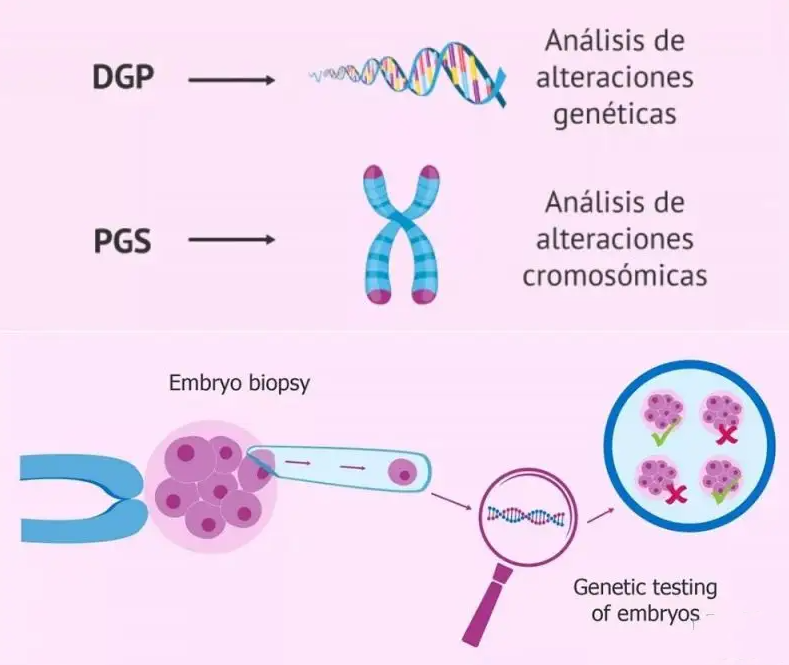 基因检查移植胚胎