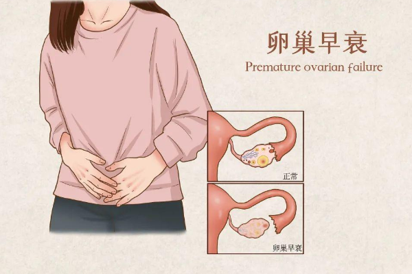 卵巢功能衰退