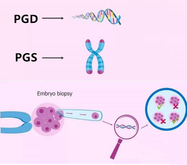 PGS/PGD技术