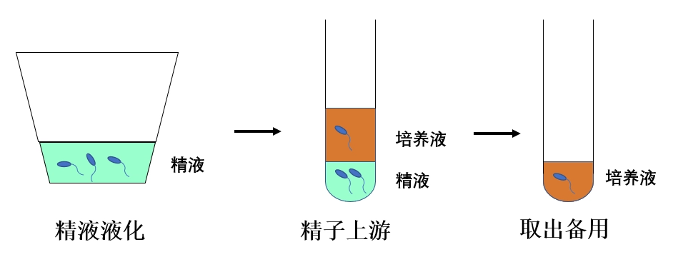 精子洗涤技术