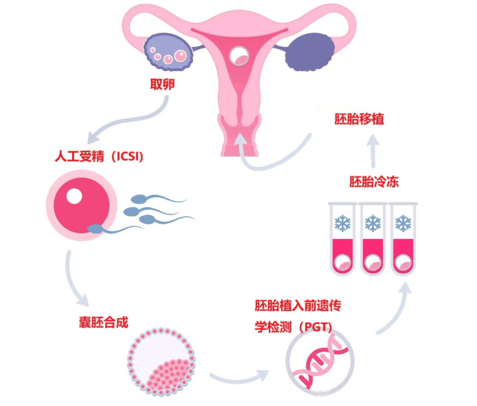 试管婴儿方案