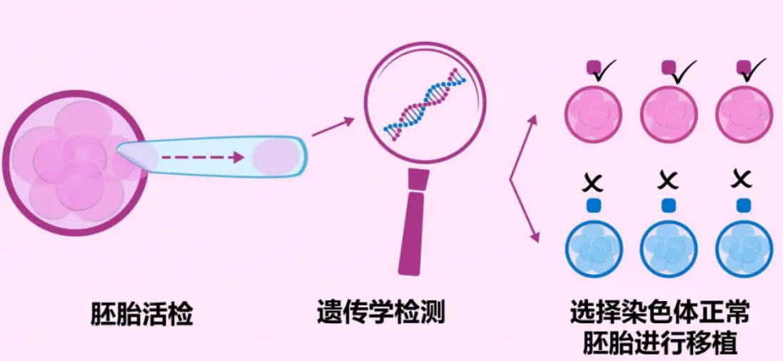 美国第三代试管婴儿