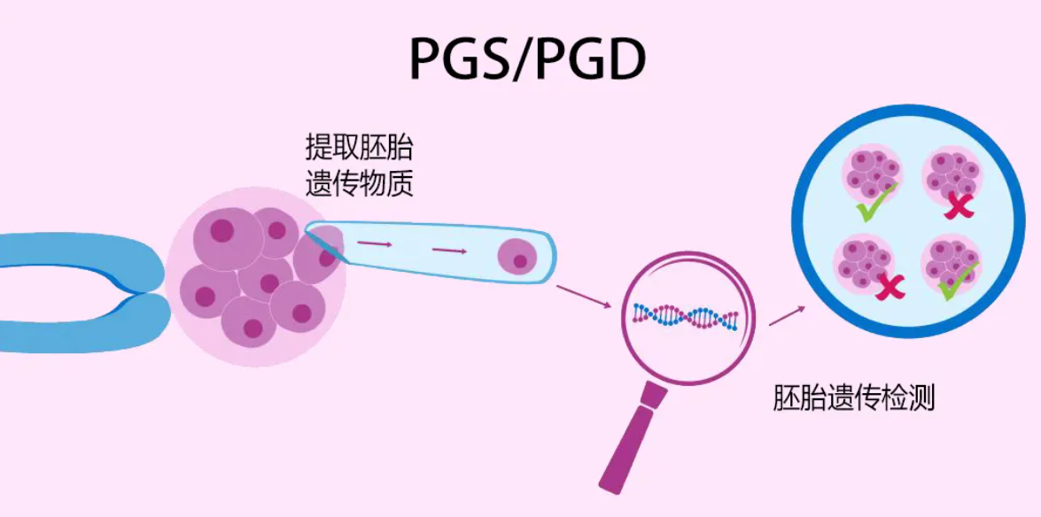 PGS/PGD技术