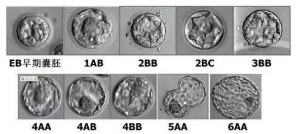 囊胚胚胎等级