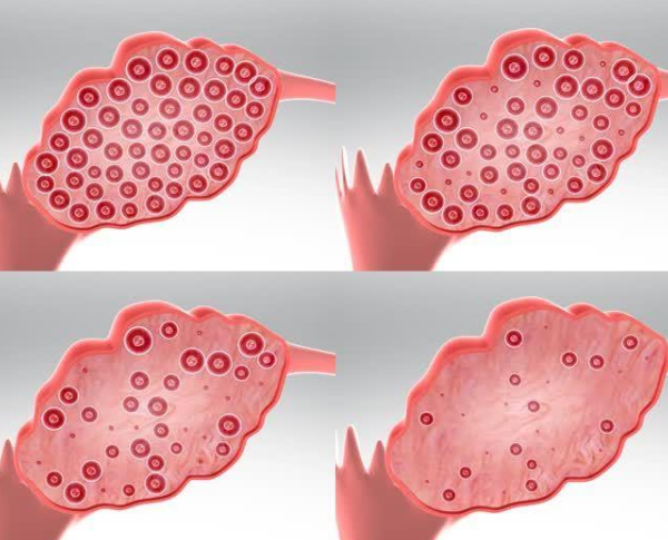 卵巢数量逐渐减少