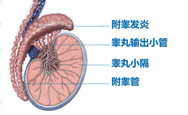 附睾炎