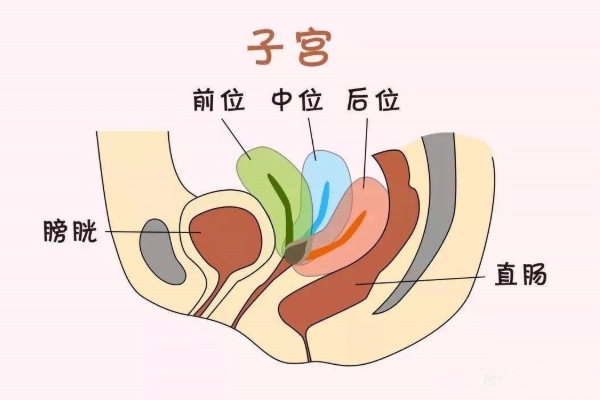 子宫后位