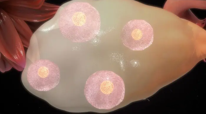 卵巢卵泡