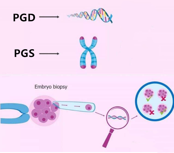 pgs遗传基因筛查技术