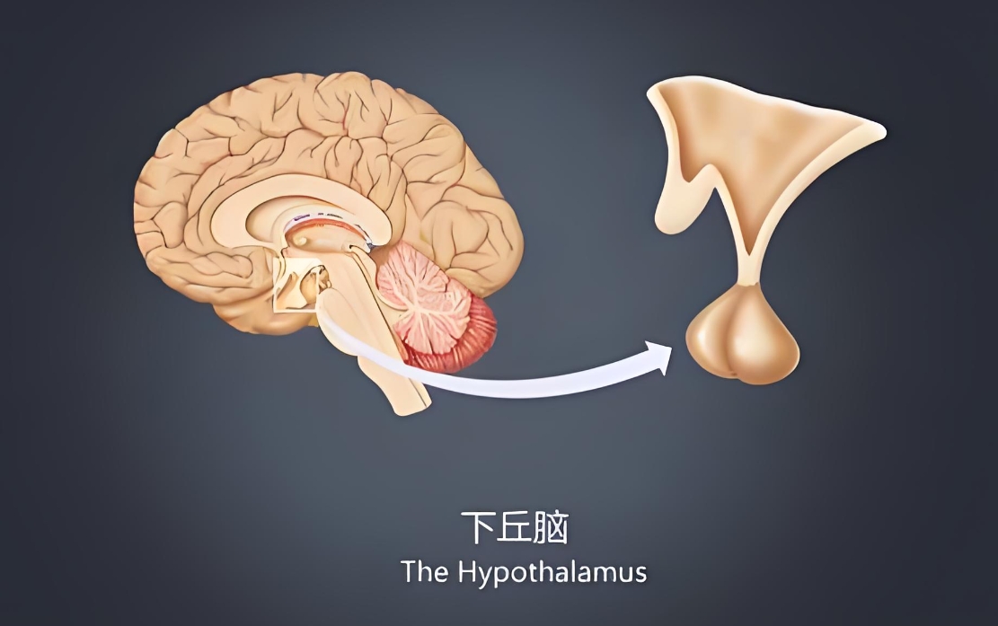 下丘脑功能障碍