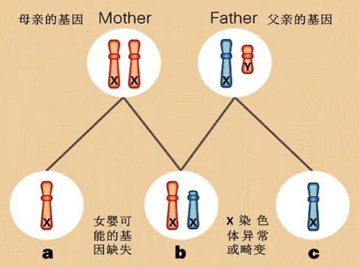 染色体异常