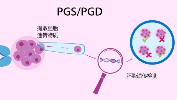 PGS/PGD技术