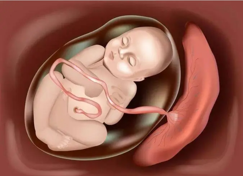 胎儿生长迟缓