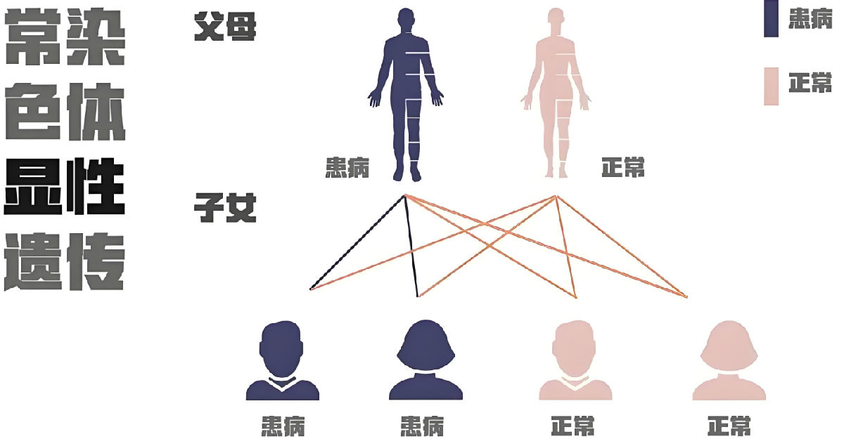 常染色体显性遗传