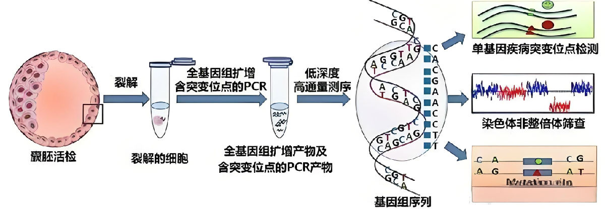 美国第三代试管婴儿技术