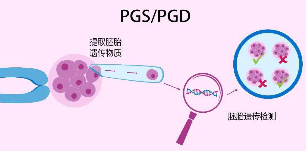 第三代试管婴儿技术挑选囊胚