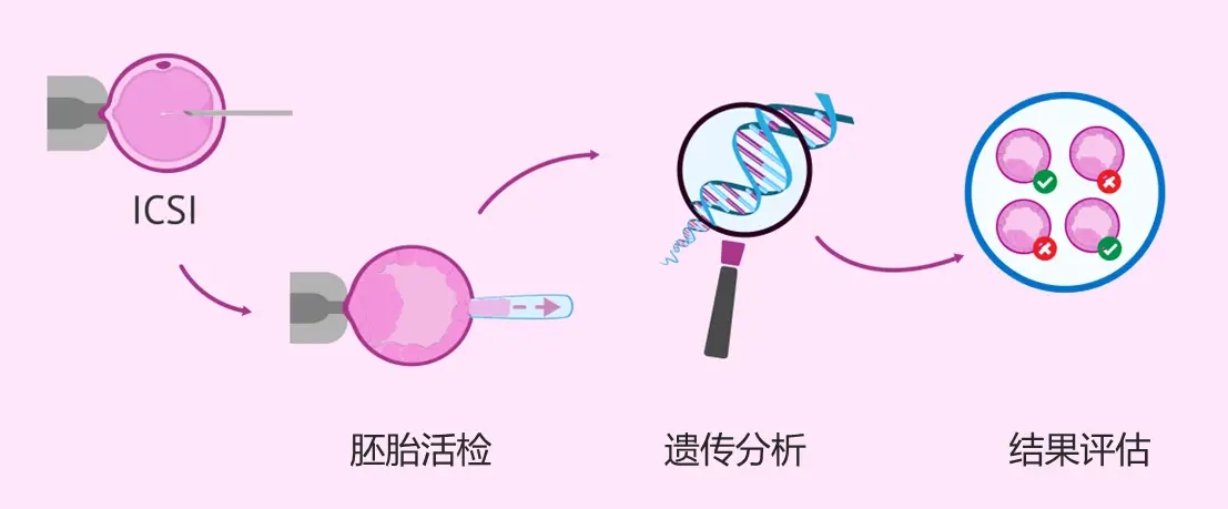 美国第三代试管婴儿技术