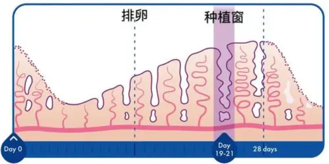 种植窗