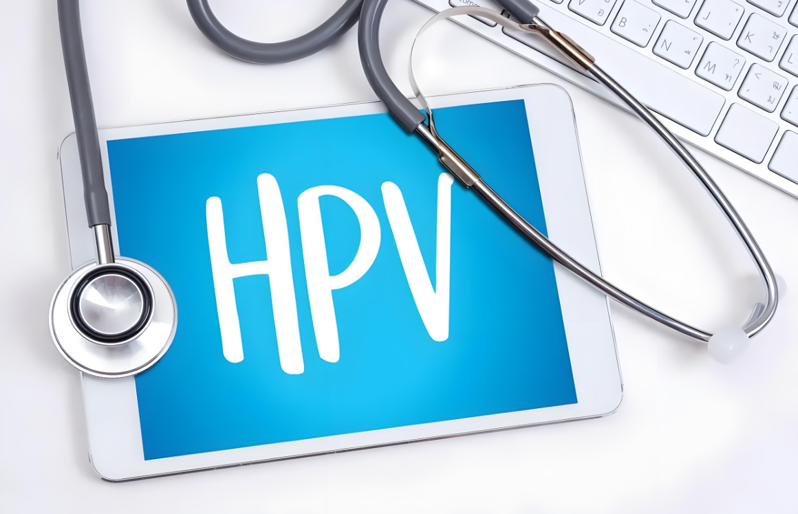 HPV检查