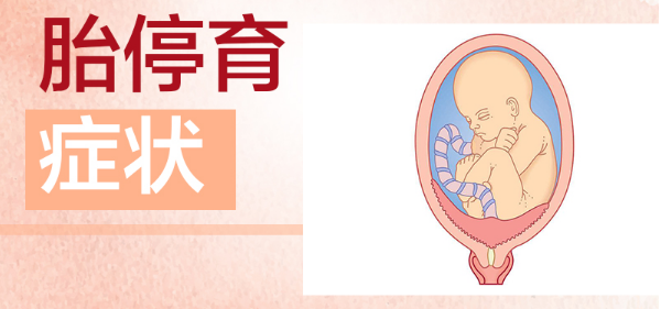 胚胎停育