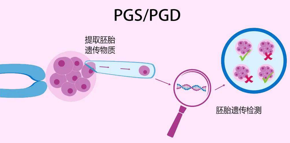 囊胚基因诊断